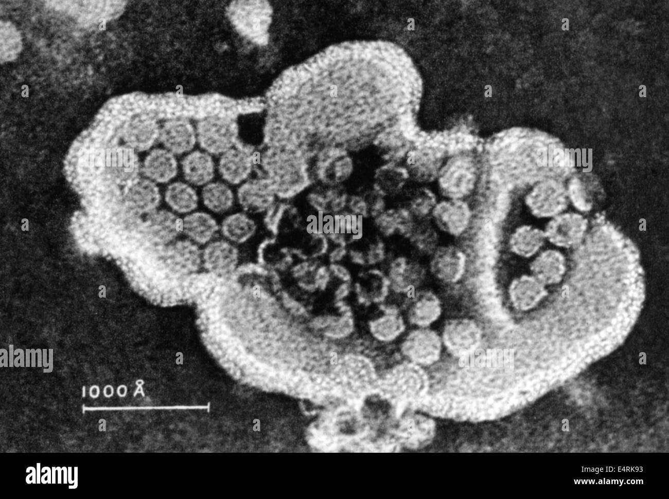 medicine, disease, poliomyelitis, virus, 20th century, 20th century, microscopy, microscope image, microscope images, pathogen, pathogenic germ, pathogenic agent, pathogens, pathogenic germs, pathogenic agents, muscular atrophy, myopathy, muscle, muscles, musculature, muscular system, inflammable illness of the spinal cord, medicine, medicines, diseases, illnesses, disease, illness, poliomyelitis, polio, infantile paralysis, virus, viruses, historic, historical, Additional-Rights-Clearences-Not Available Stock Photo