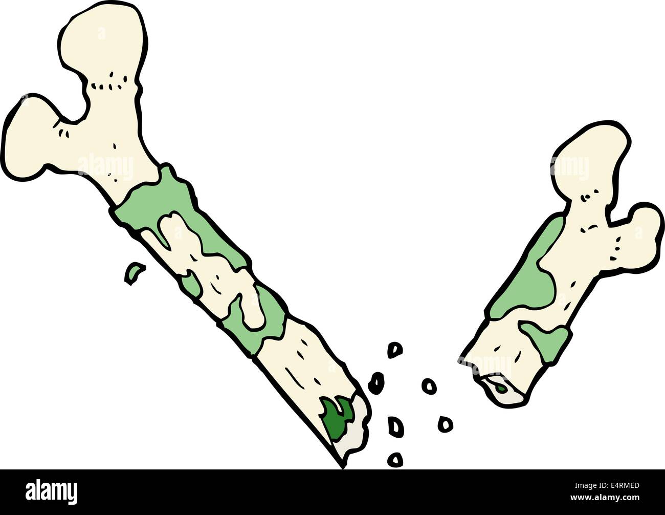 gross broken bone cartoon Stock Vector Image & Art - Alamy gross broken bone cartoon Stock Vector Image & Art - Alamy
