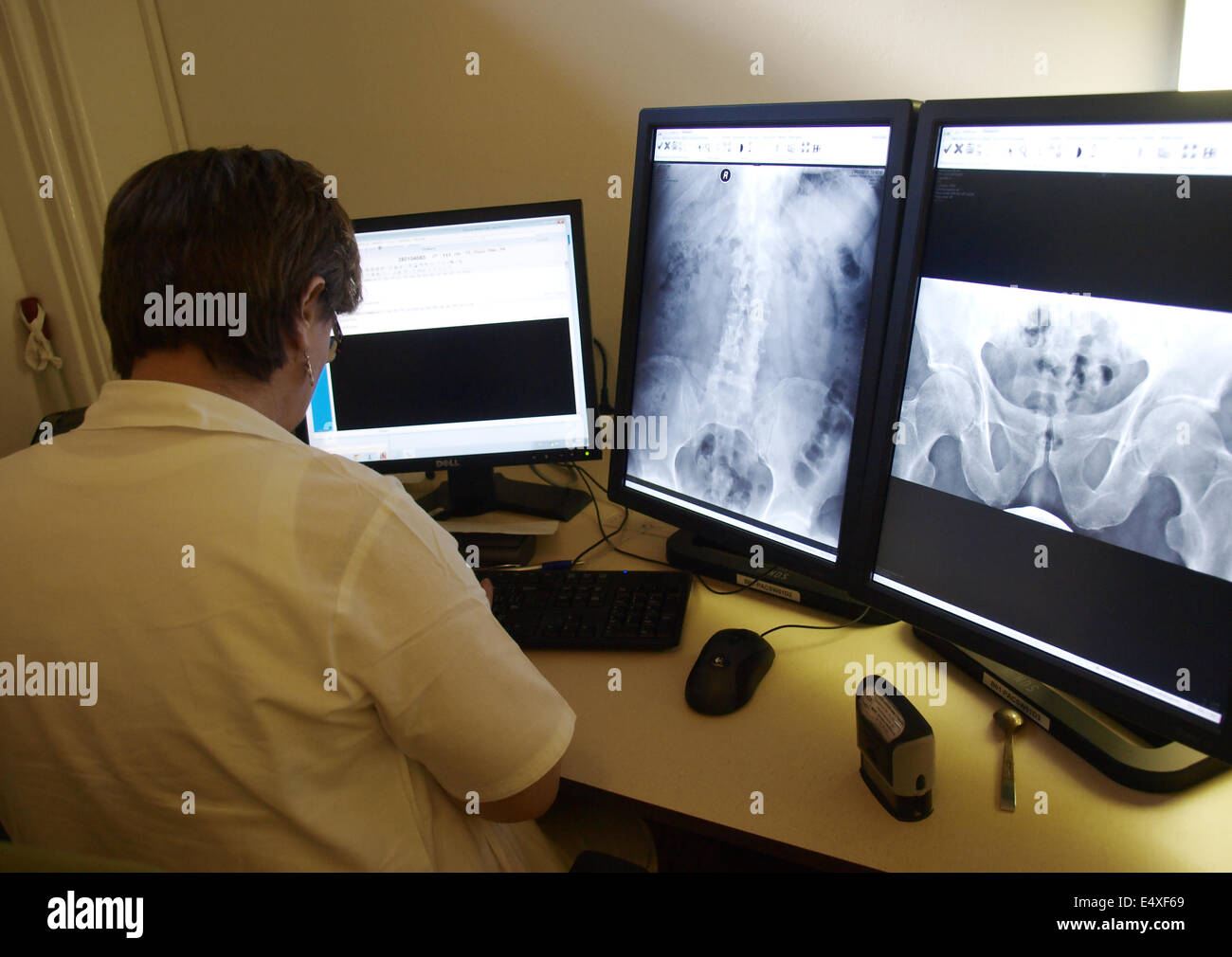 Doktor, diagnostic, Xray Stock Photo Alamy
