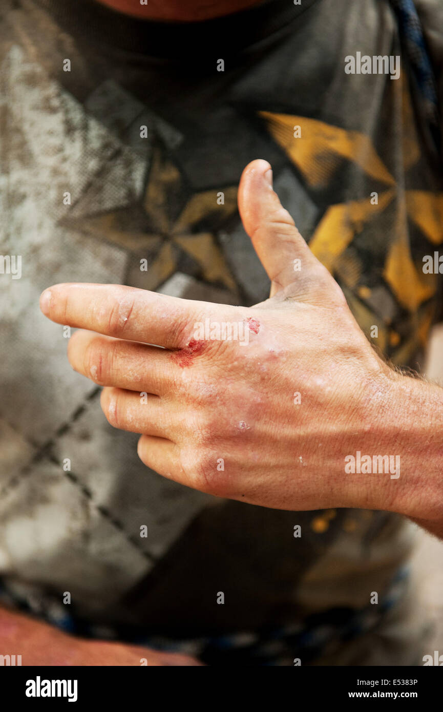 A climber's hands show skinned knuckles from a long climb on the