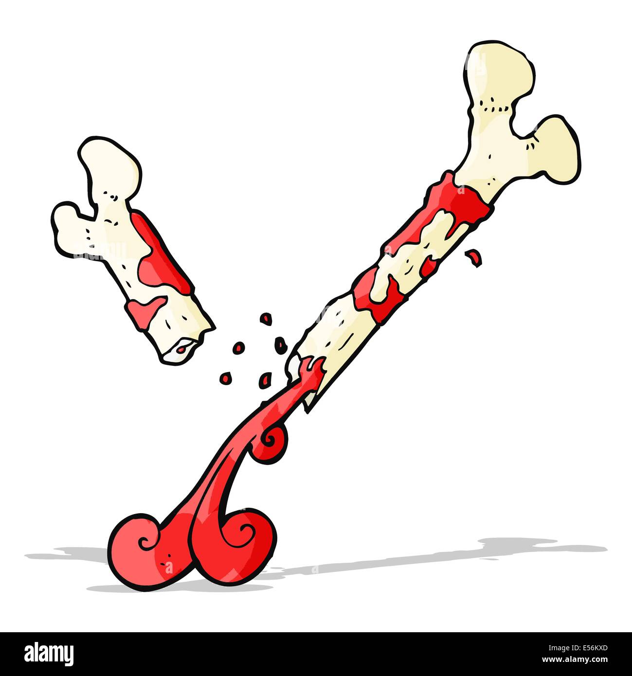 gross broken bone cartoon Stock Vector Image & Art - Alamy