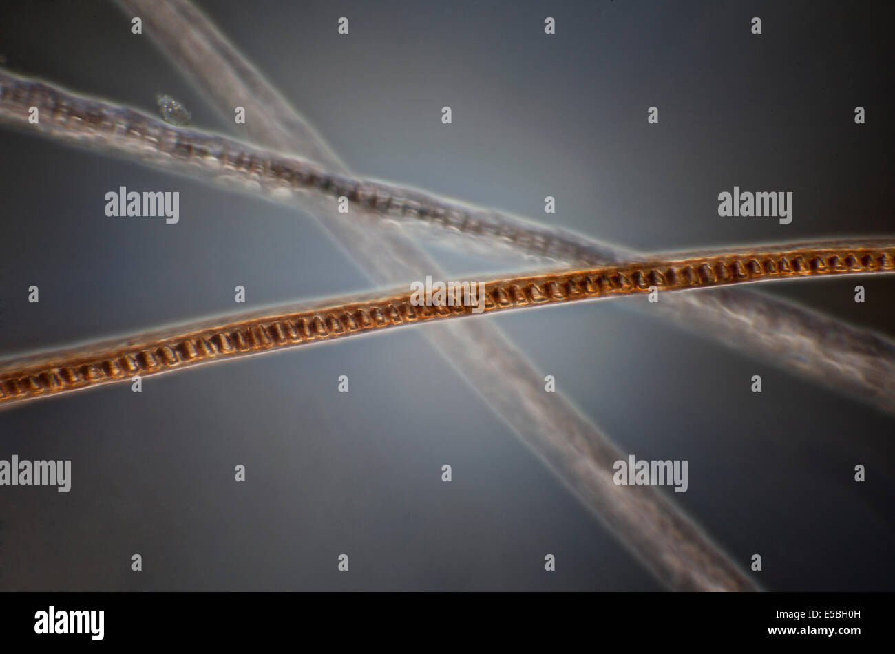 Trichome - plant hair - under the microscope, horizontal field of view is  about 0.58mm Stock Photo - Alamy