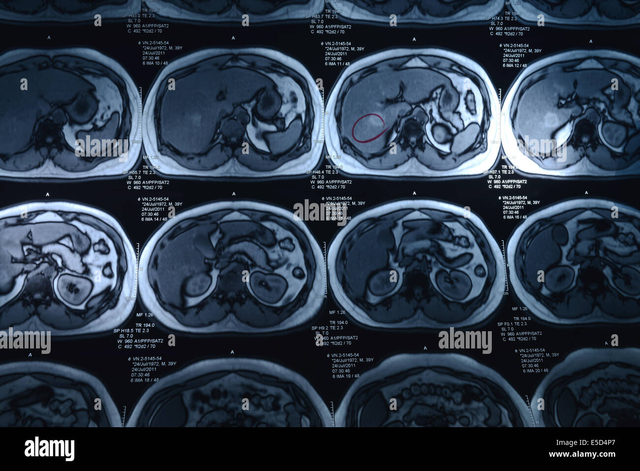 Full body x ray hires stock photography and images Alamy