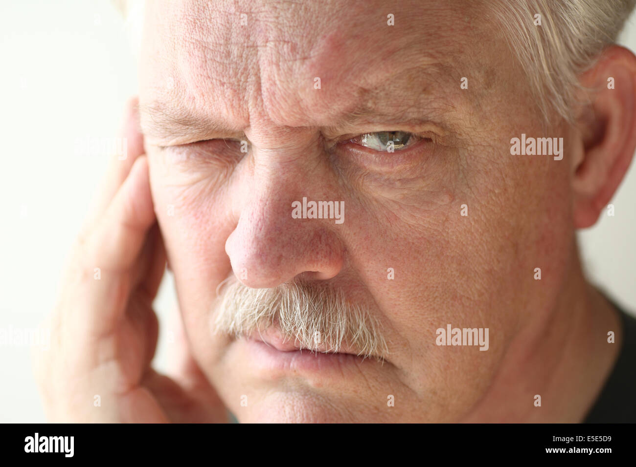 man with pain or irritation on one side of his face Stock Photo