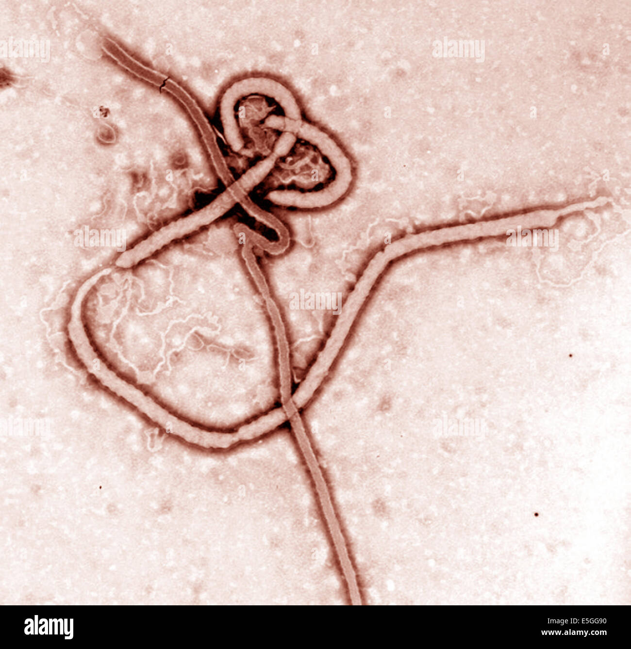 The Ebola virus. Ebola hemorrhagic fever (Ebola HF) is a severe, often-fatal disease in humans and nonhuman primates (monkeys, g Stock Photo