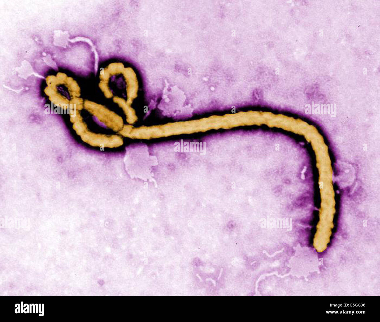 The Ebola virus. Ebola hemorrhagic fever (Ebola HF) is a severe, often-fatal disease in humans and nonhuman primates. Stock Photo