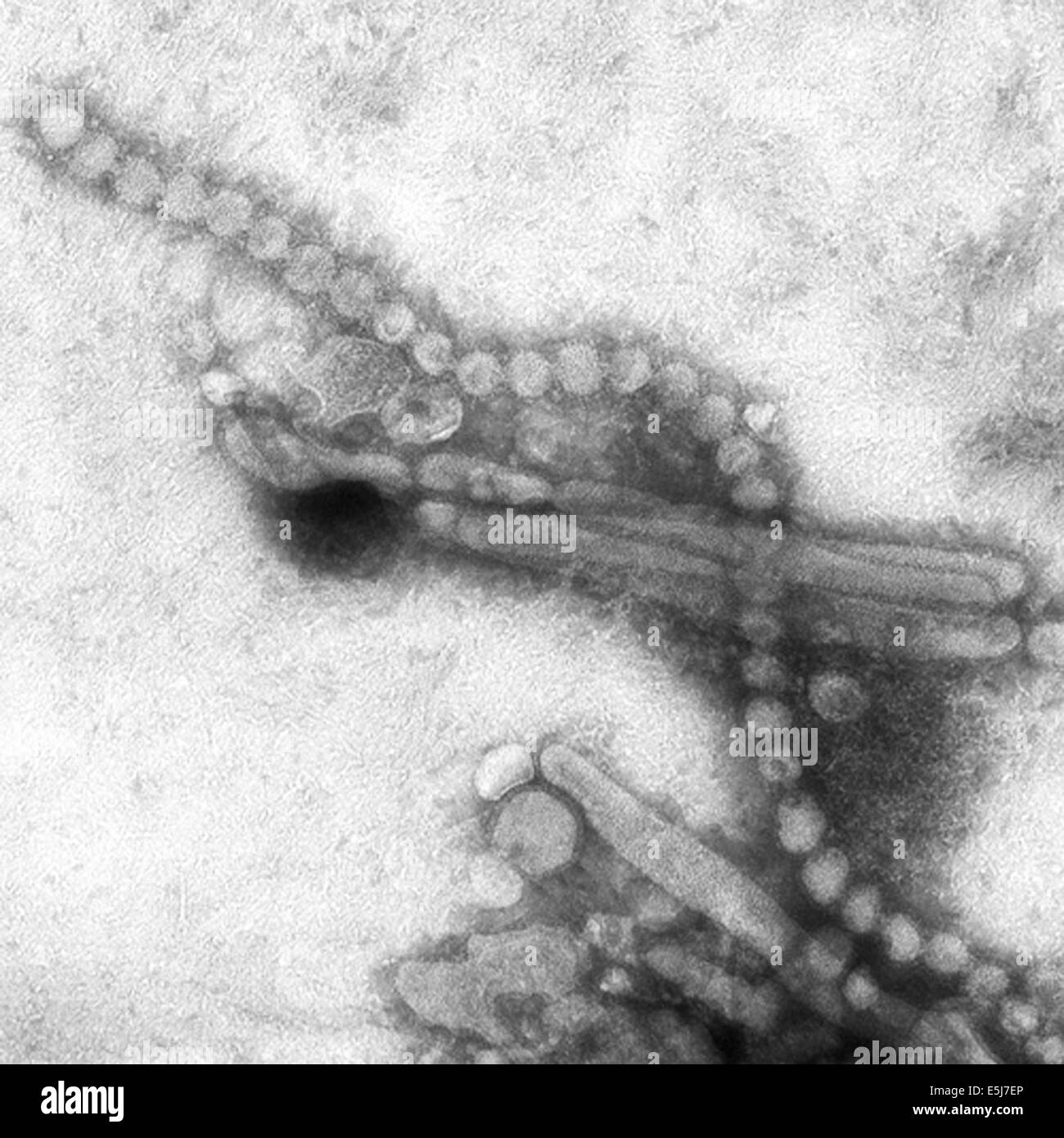 Influenza  H7N9  virus as viewed through an electron microscope. Both filaments and spheres are observed in this photo from the archives of Press Portrait Service Stock Photo
