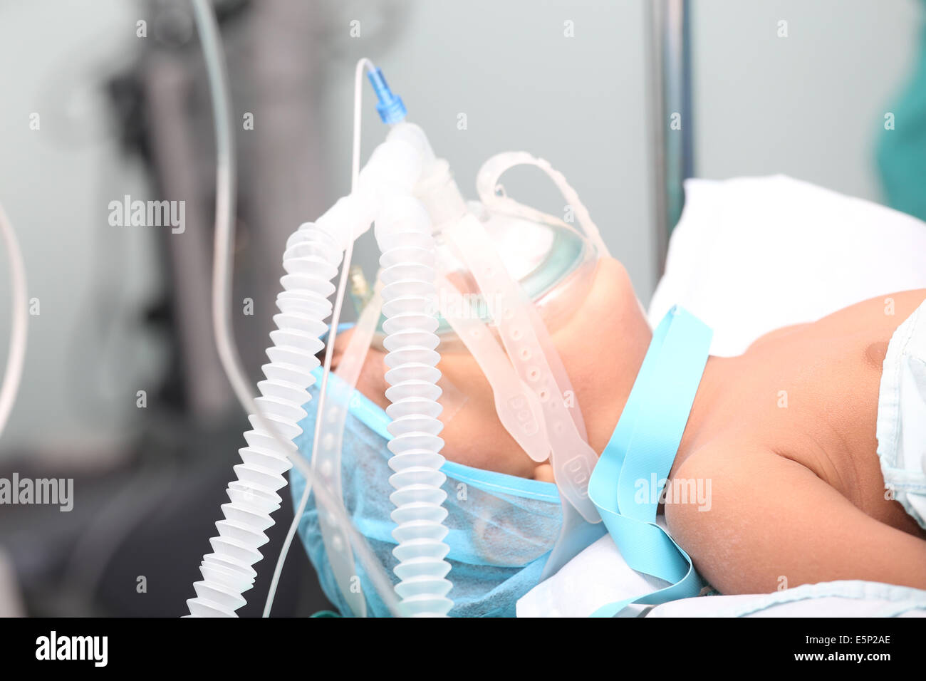 Unidentified boy with oxygen mask in the surgery. Focus in the mask tubes. Stock Photo