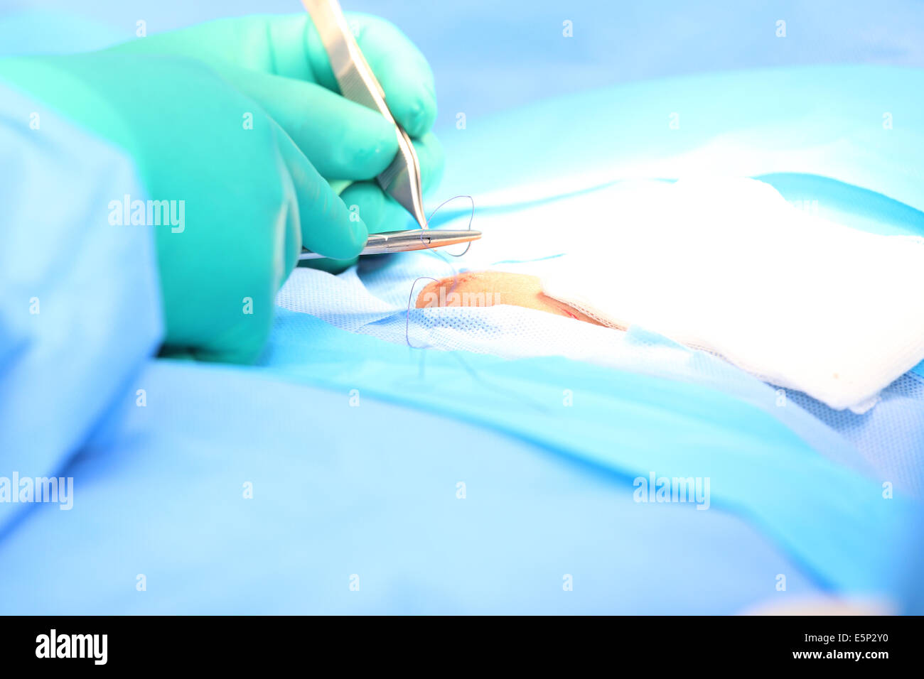 Doctor suturing an hernia.  Focus in the tools Stock Photo