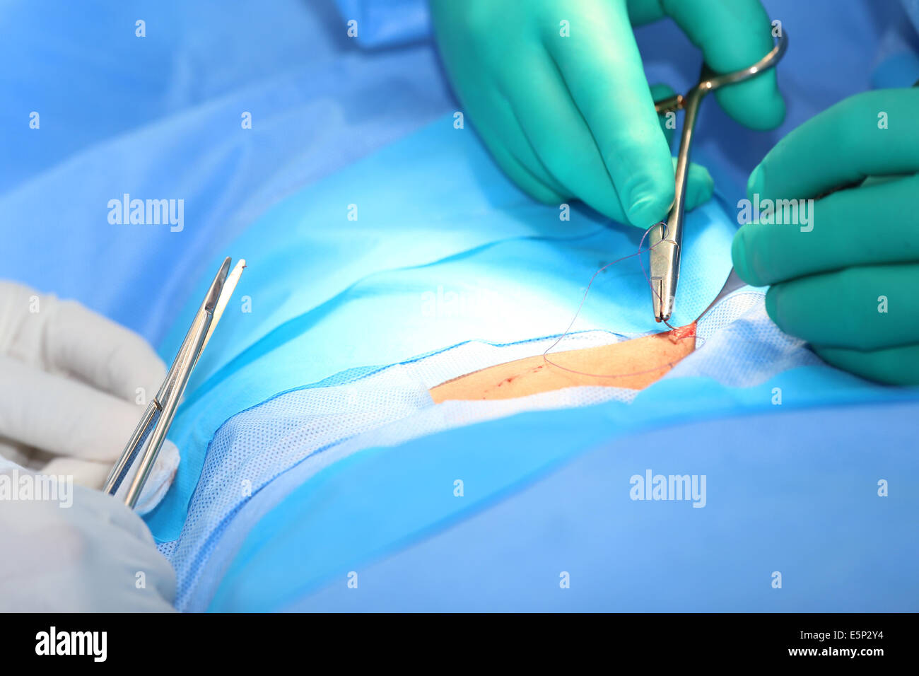Macro shot of doctors making a suture in operation room.  Focus in the tools. Stock Photo