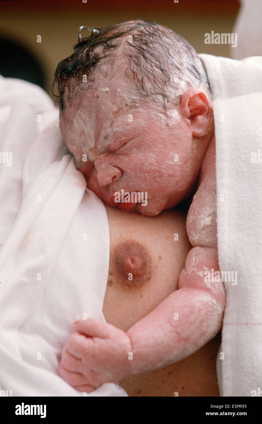 New born baby with vernix caseosa. Stock Photo