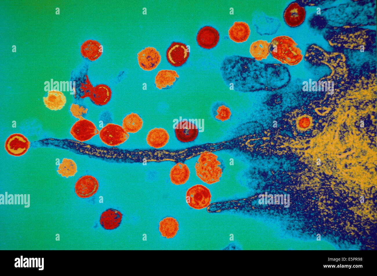 electron microscopy hiv