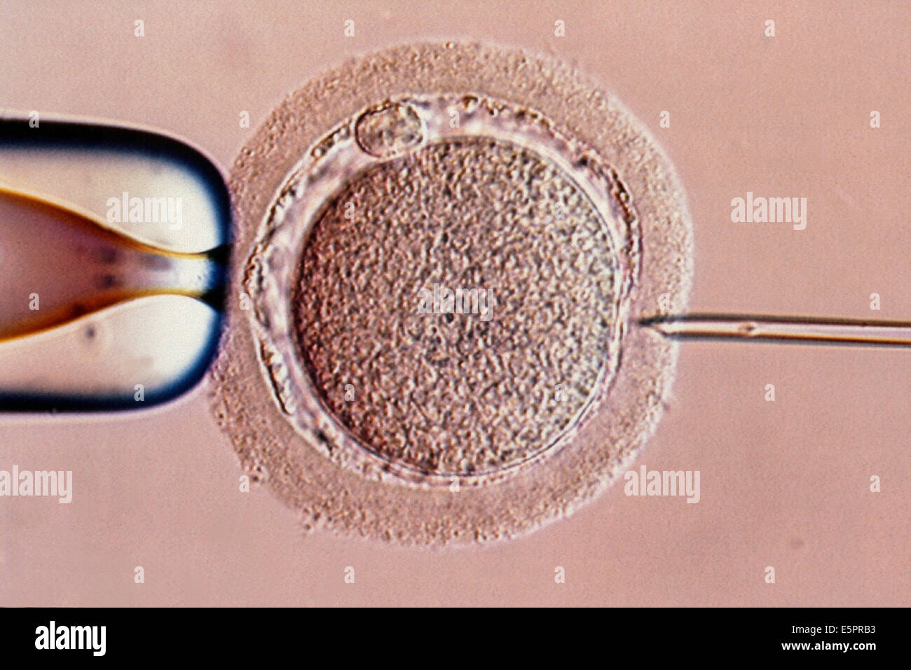 Intracytoplasmic sperm injection, Light microscope Stock Photo - Alamy