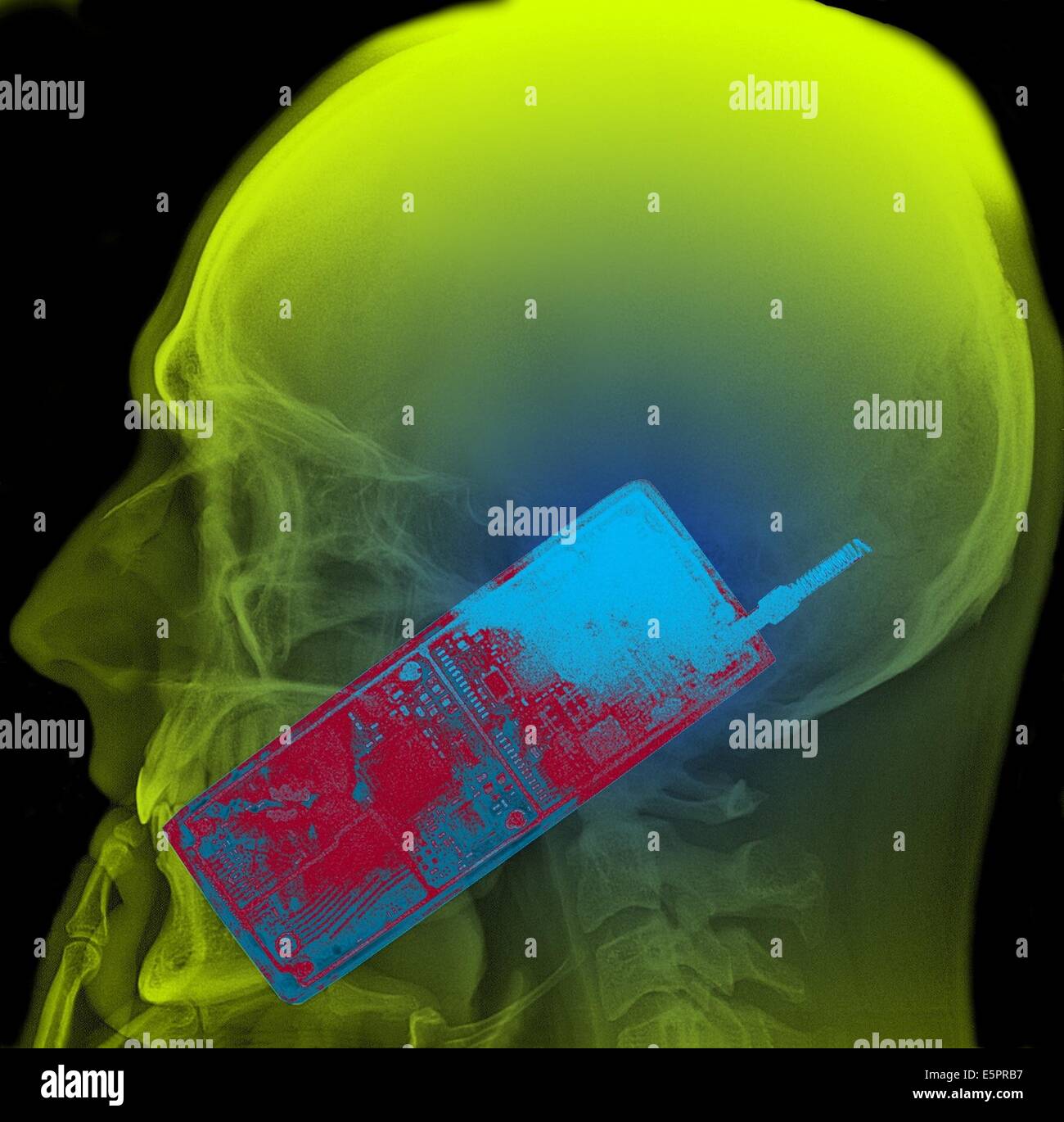 Colored Xray showing the head of a man using a mobile phone. The use