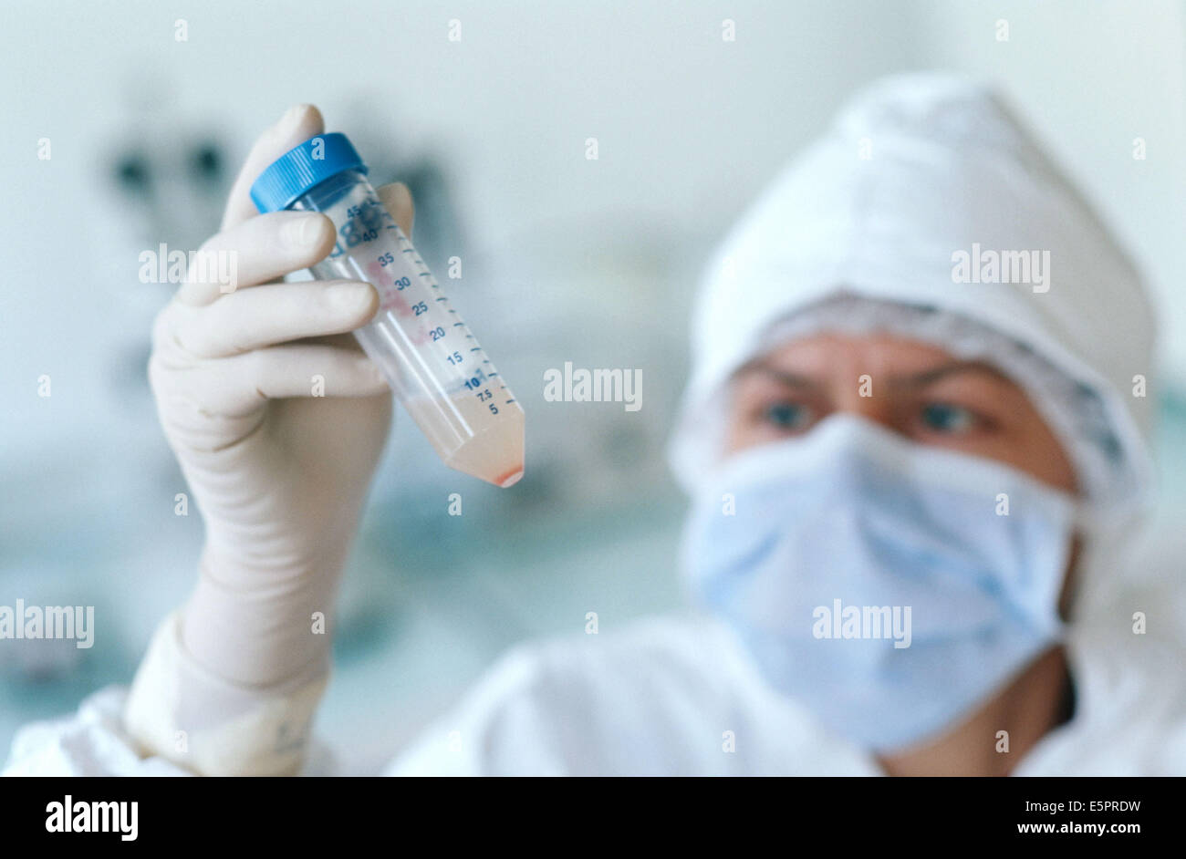 Cellular therapy, Controls and estimate of the stems cells, Umbilical cord blood sample. Stock Photo