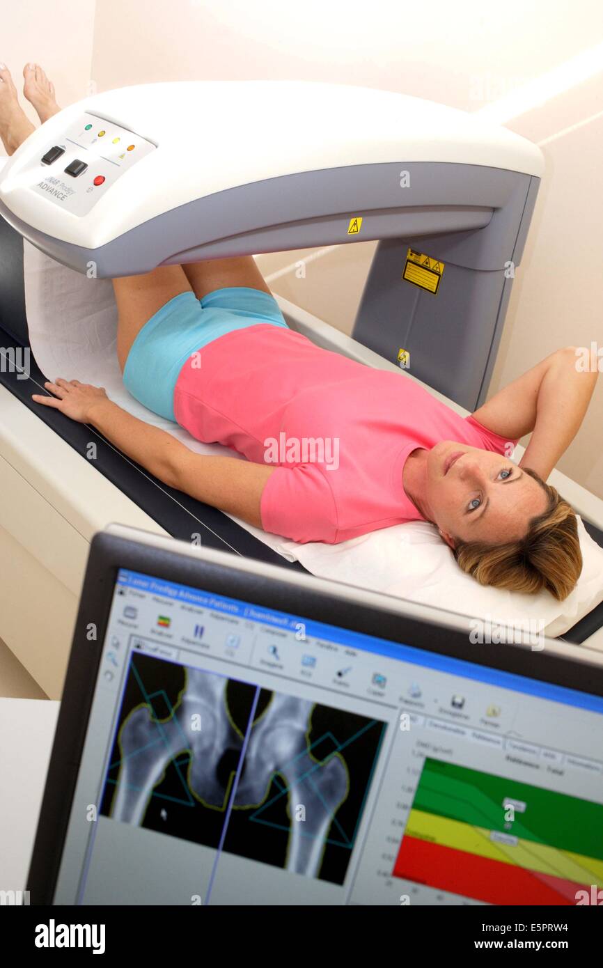 A doctor uses a bone densitometer to measure the optical density of the