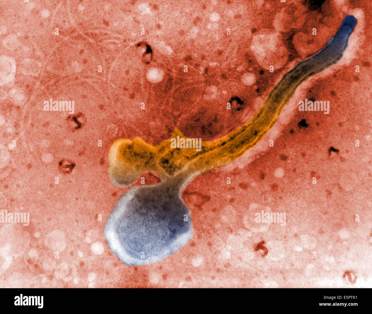 Light micrograph of a Treponema pallidum, This spirochaete bacterium is the agent of syphilis. Stock Photo