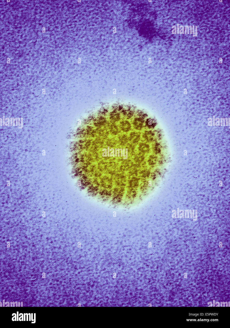 Colored transmission electron micrograph (TEM) of human papillomavirus (HPV). Stock Photo