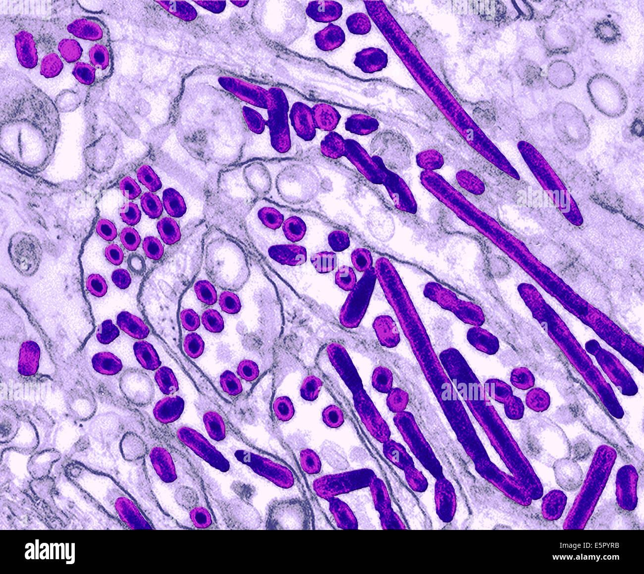 Colorized transmission electron micrograph of avian influenza A H5N1 viruses (seen in drak) grown in Madin-Darby canine kidney Stock Photo