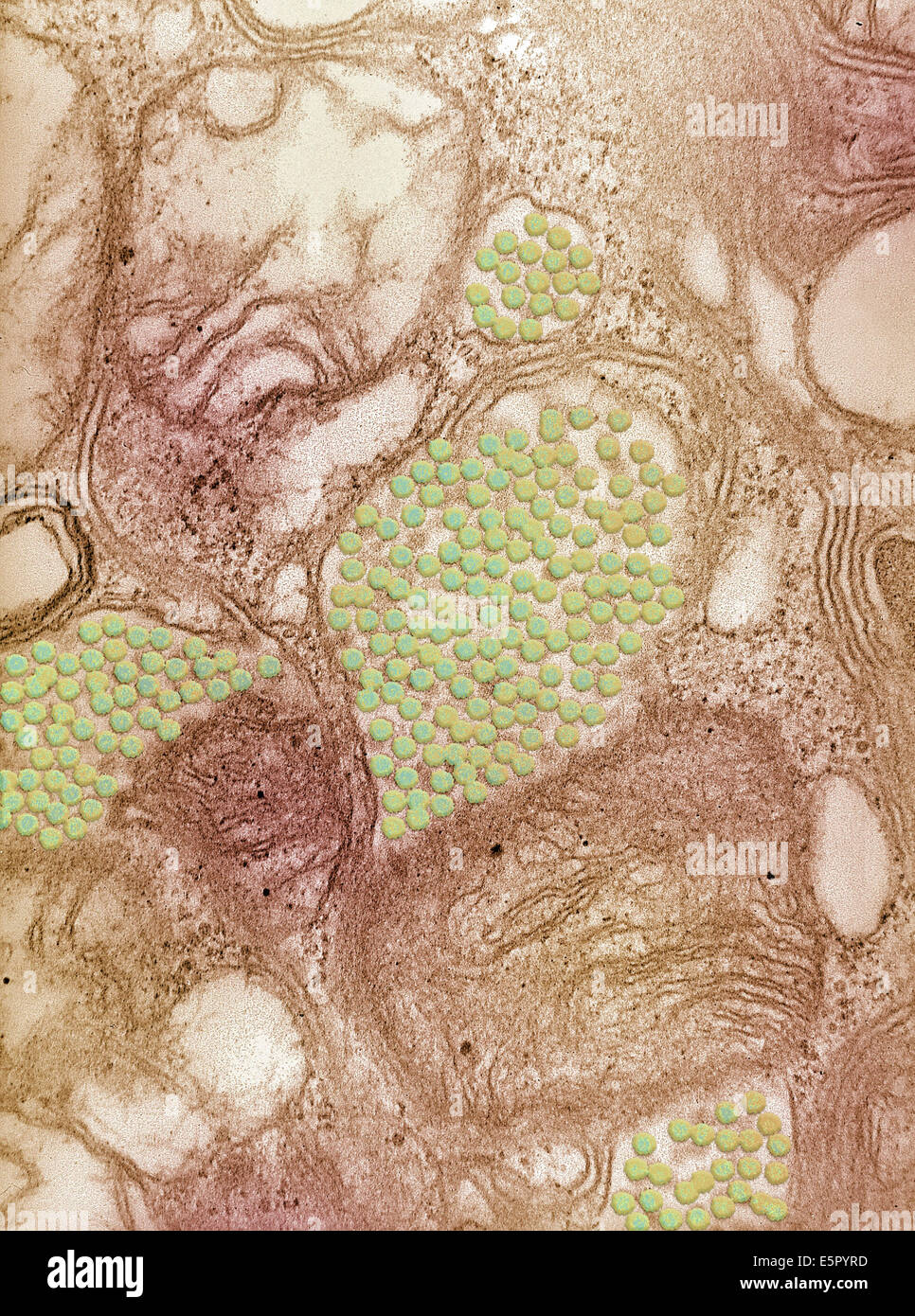 Colorized transmission electron micrograph (TEM) of Eastern equine encephalitis (EEE) viruses from a salivary gland of an Stock Photo