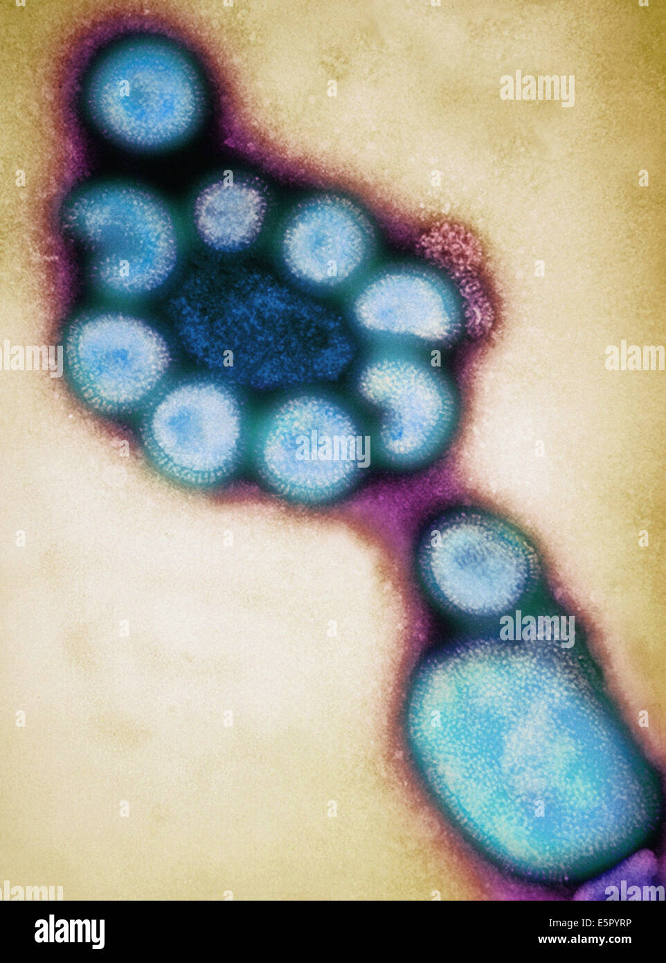 Colored transmission electron micrograph (TEM) of Hong Kong influenza