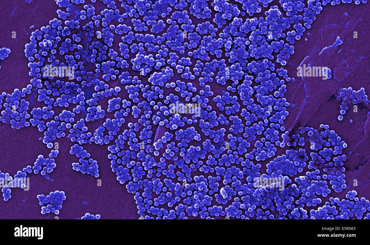 Electron micrograph (SEM) of methicillin-resistant Staphylococcus aureus bacteria (MRSA); Magnification 2390x. Stock Photo