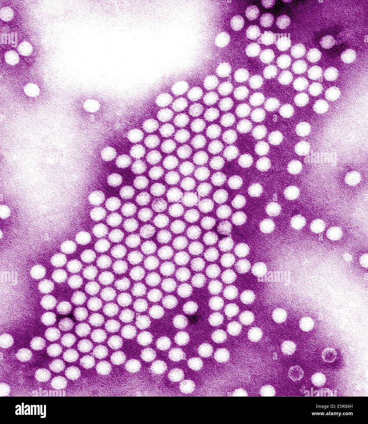 Transmission Electron Micrograph (TEM) of poliovirus, an RNA enterovirus responsable for poliomyelitis. Stock Photo