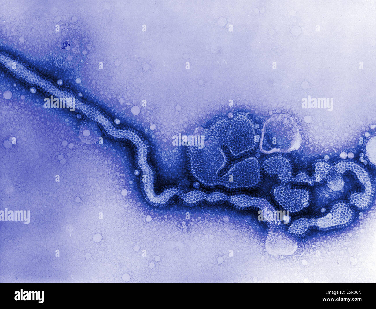 Transmission electron micrograph of influenza C virus. Stock Photo