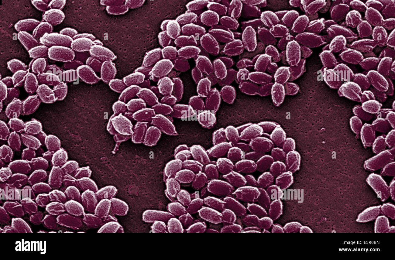 Electron micrograph of spores of Bacillus anthracis, a Gram-positive species of bacteria which is highly pathogenic and causes Stock Photo