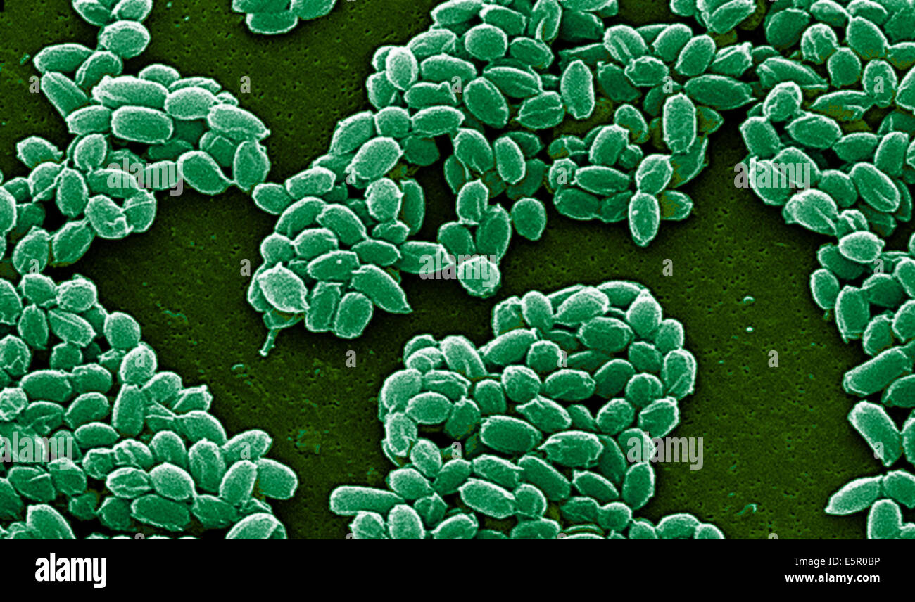 Electron micrograph of spores of Bacillus anthracis, a Gram-positive species of bacteria which is highly pathogenic and causes Stock Photo