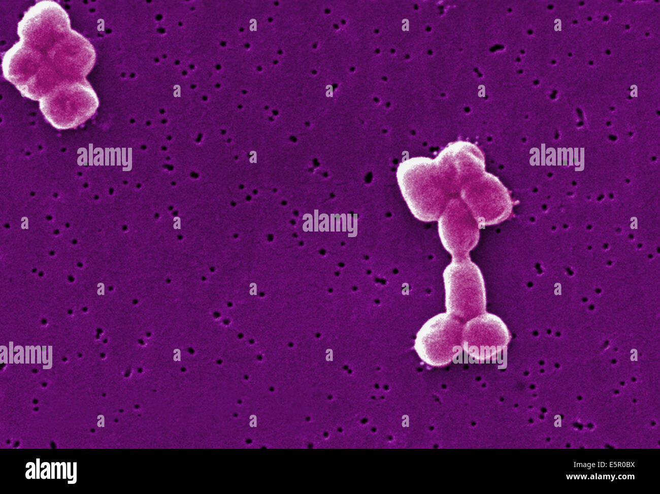Scanning Electron micrograph (SEM) of Acinetobacter baumannii, This aerobic Gram-negative, non-motile bacteria are normal flora Stock Photo