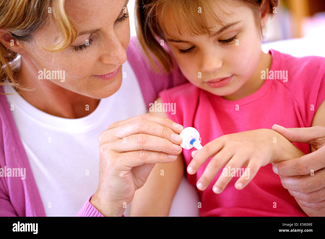 Treatment against warts by cryotherapy Stock Photo Alamy