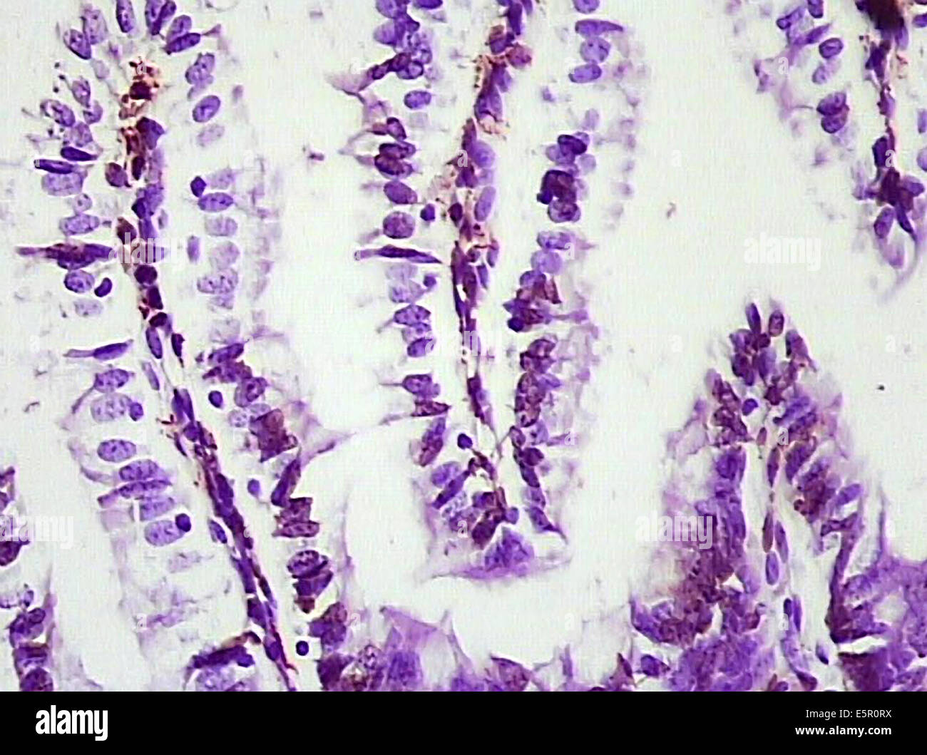 Photomicrograph of the villi lining the intestine walls. Stock Photo