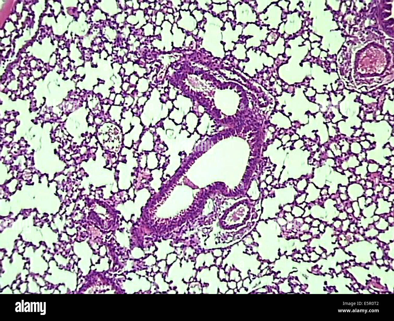 Photomicrograph of lung tissus showing a section of brunchus at center with surrounding blood vessels. Stock Photo