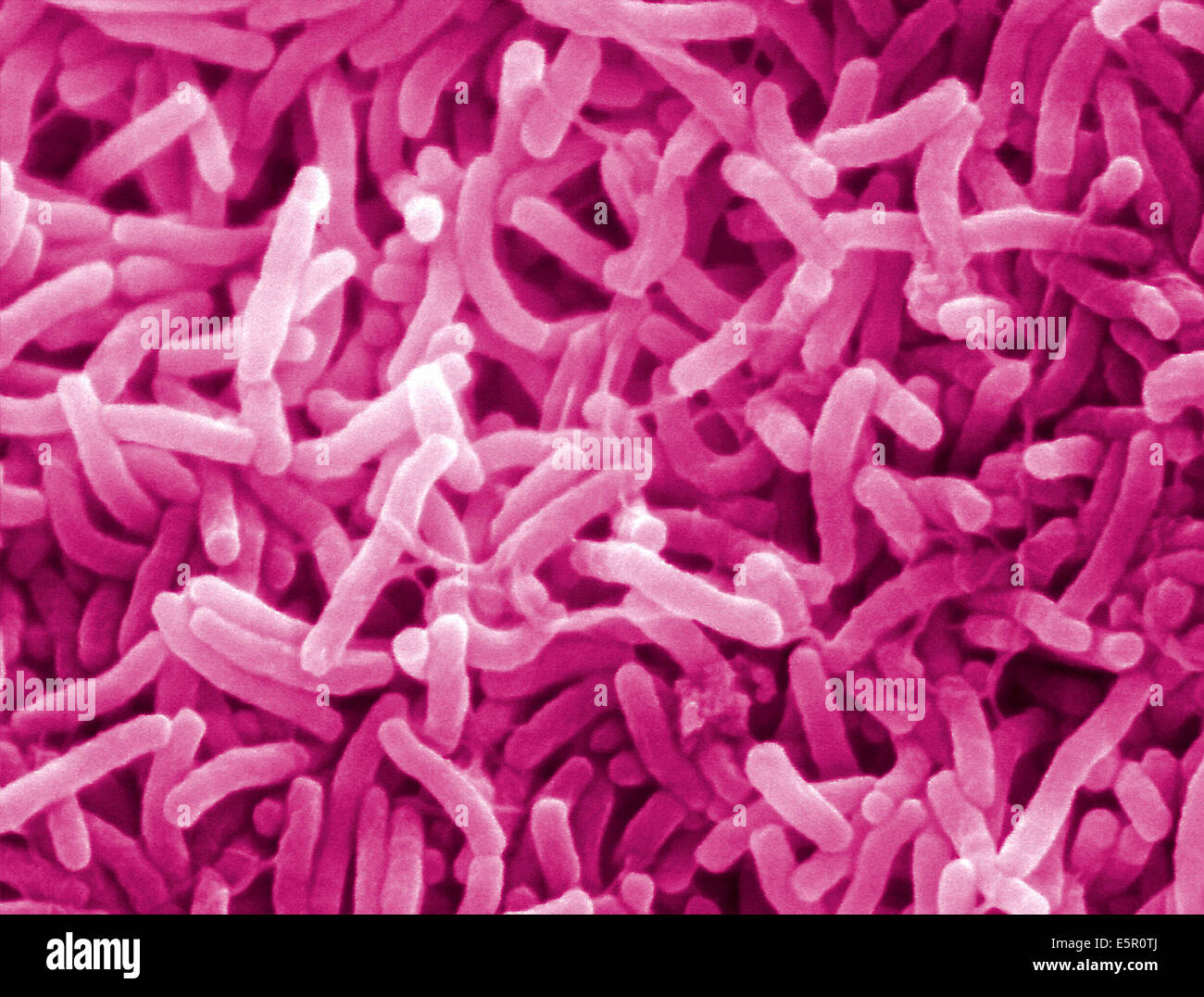 Scanning electron micrograph (SEM) of Vibrio cholerae bacteria, This Gram-negative bacterium causes cholera. Stock Photo