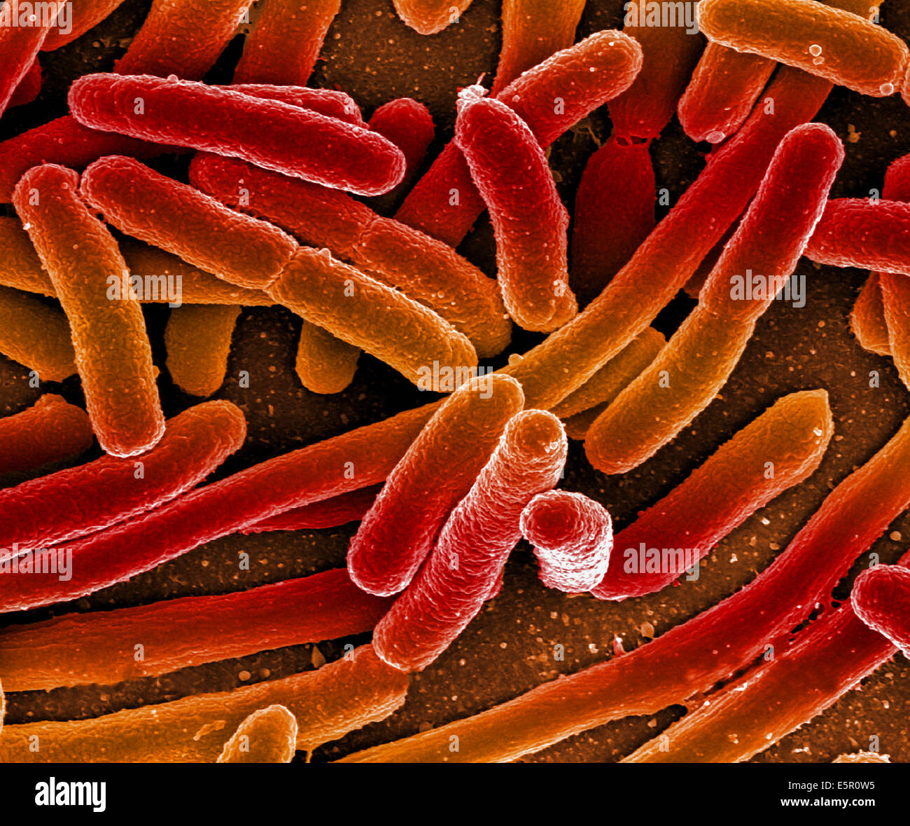 Scanning electron micrograph (SEM) of Escherichia coli bacteria. Stock Photo
