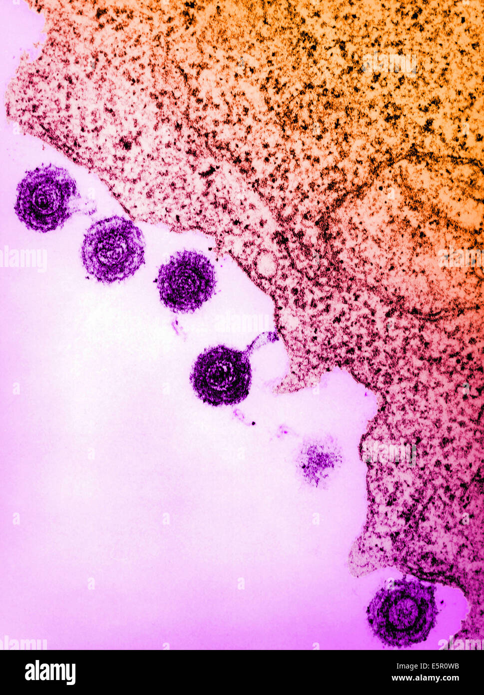 Transmission electron micrograph (TEM) of human herpes virus-6 (HHV-6) previously called HBLV (human b-lymphotropic virus). It Stock Photo