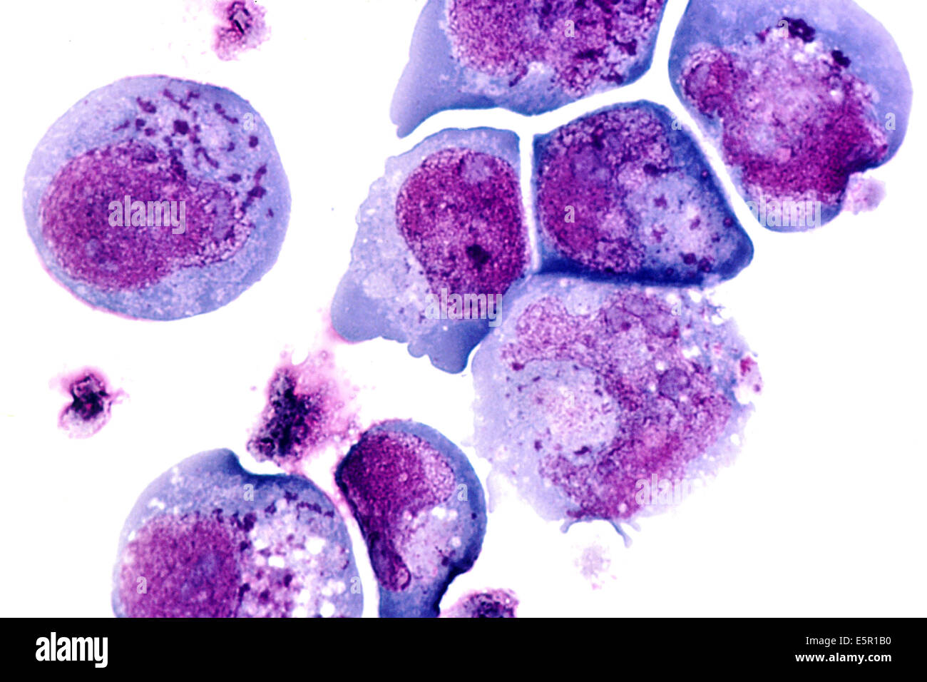 Photomicrograph of the human herpes virus-6 (HHV-6) previously called HBLV (human b-lymphotropic virus), It infects lymphocyte Stock Photo