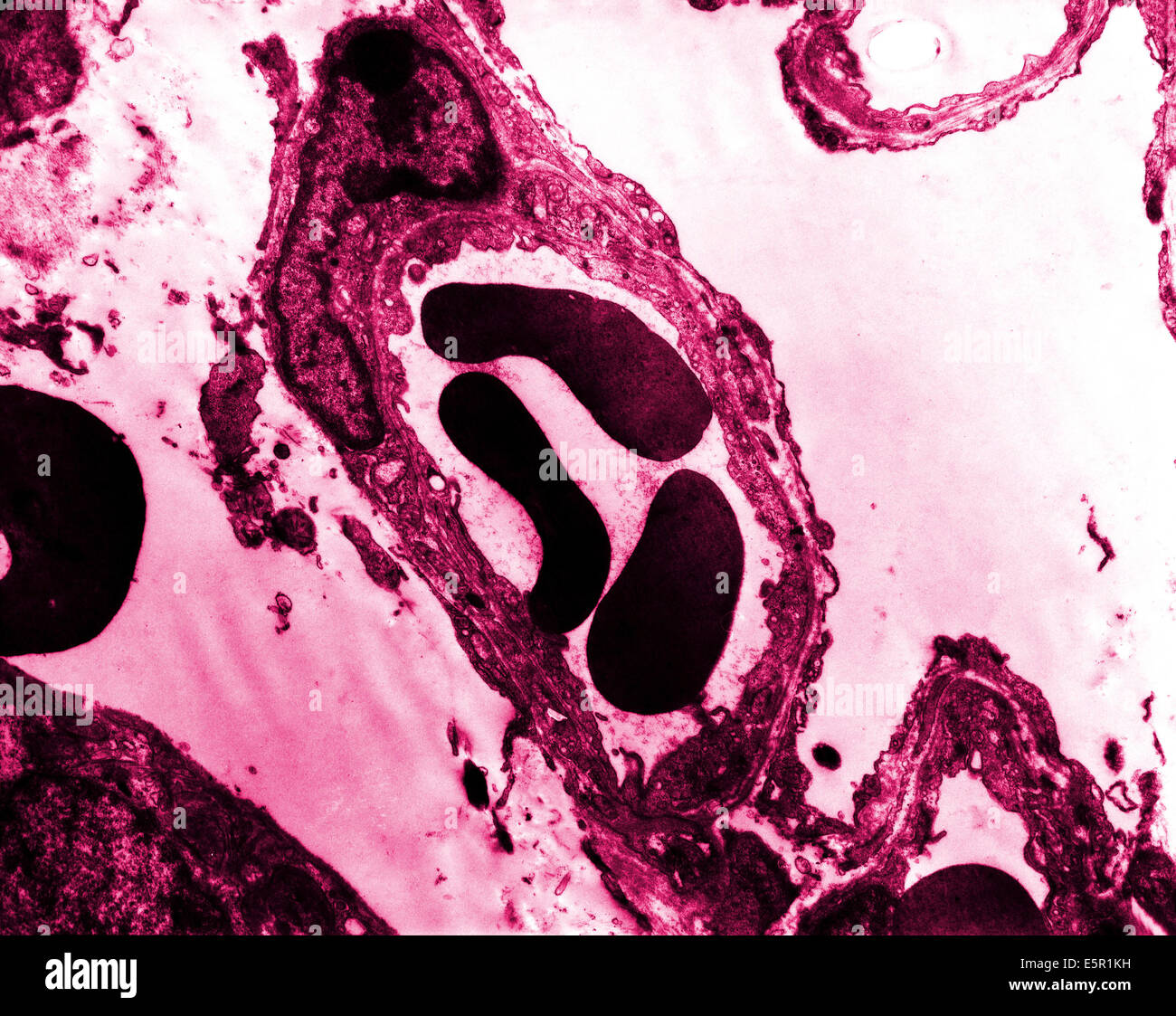 Transmission electron microscopy cells hires stock photography and images Alamy