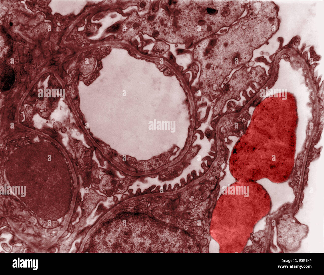 Transmission electron microscopy cells hires stock photography and