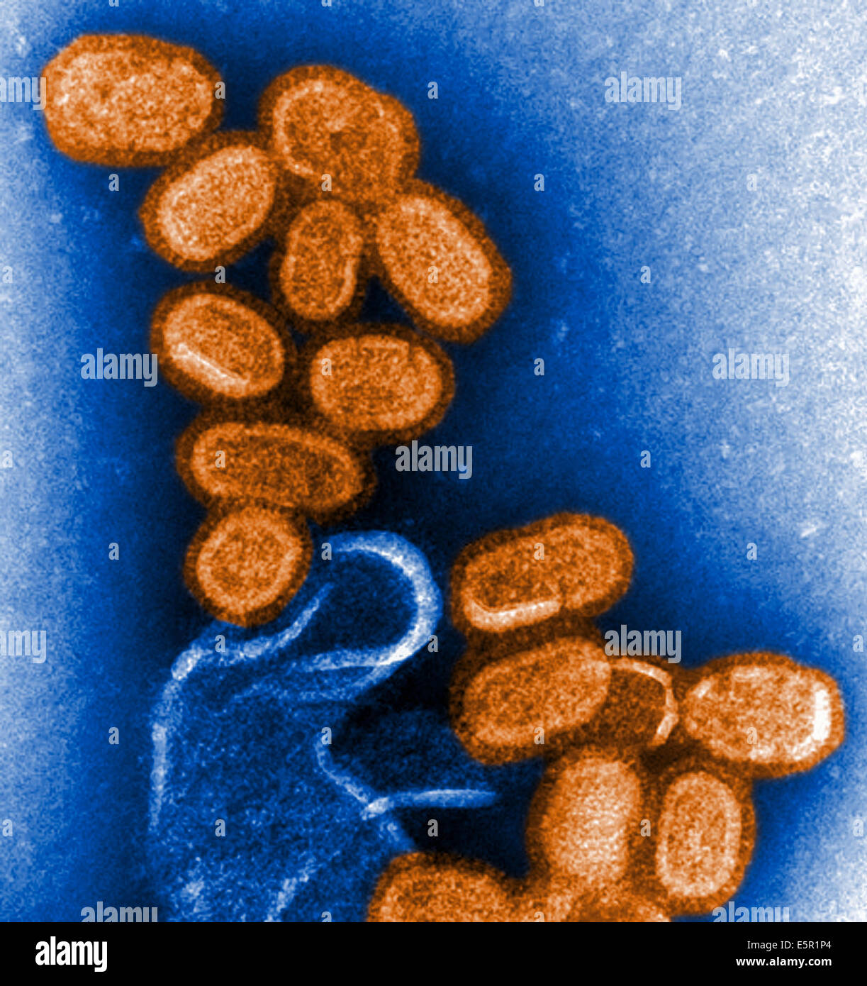 Influenza A virus causes flu , Transmission Electron Micrograph (TEM). Stock Photo