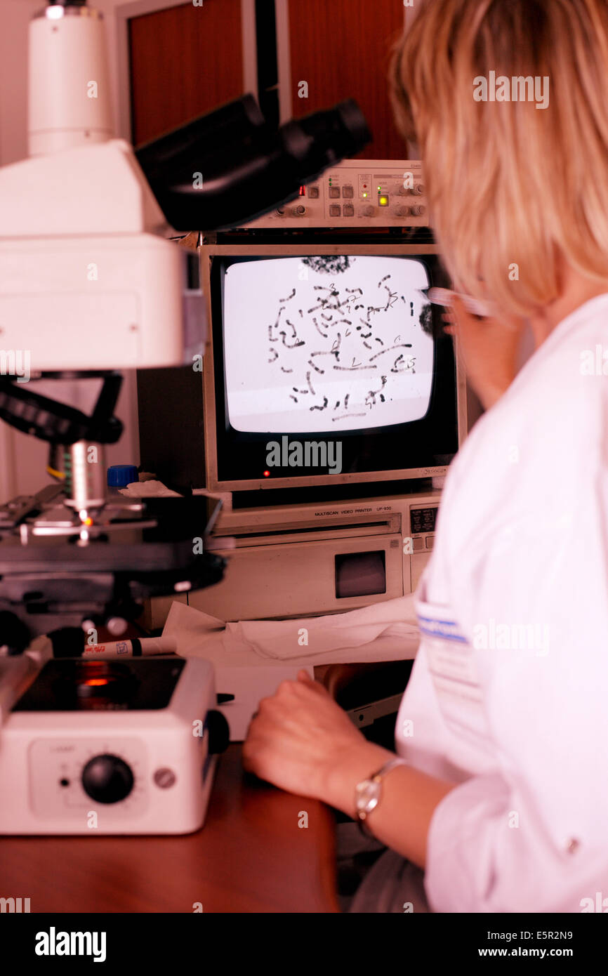 Antenatal diagnosis : microscopic observation and analysis of the chromosomes Cytogenetics and reproductive biology unit, Stock Photo