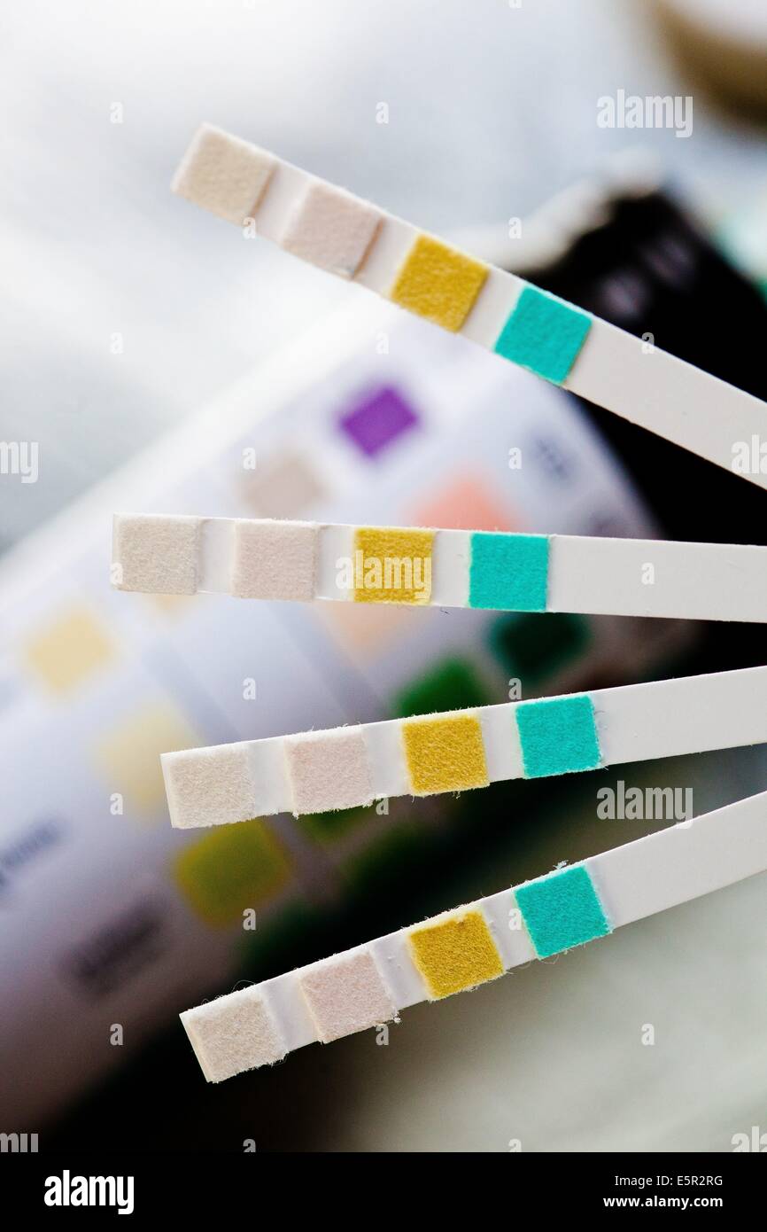 Multiple urine test strips for urinary tract infection (UTI) screening Stock Photo Alamy