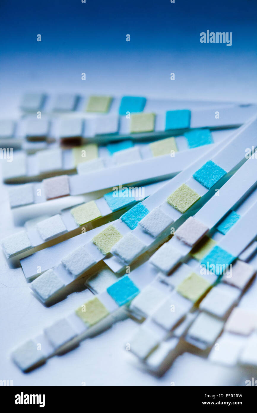 Multiple urine test strips for urinary tract infection (UTI) screening Stock Photo Alamy