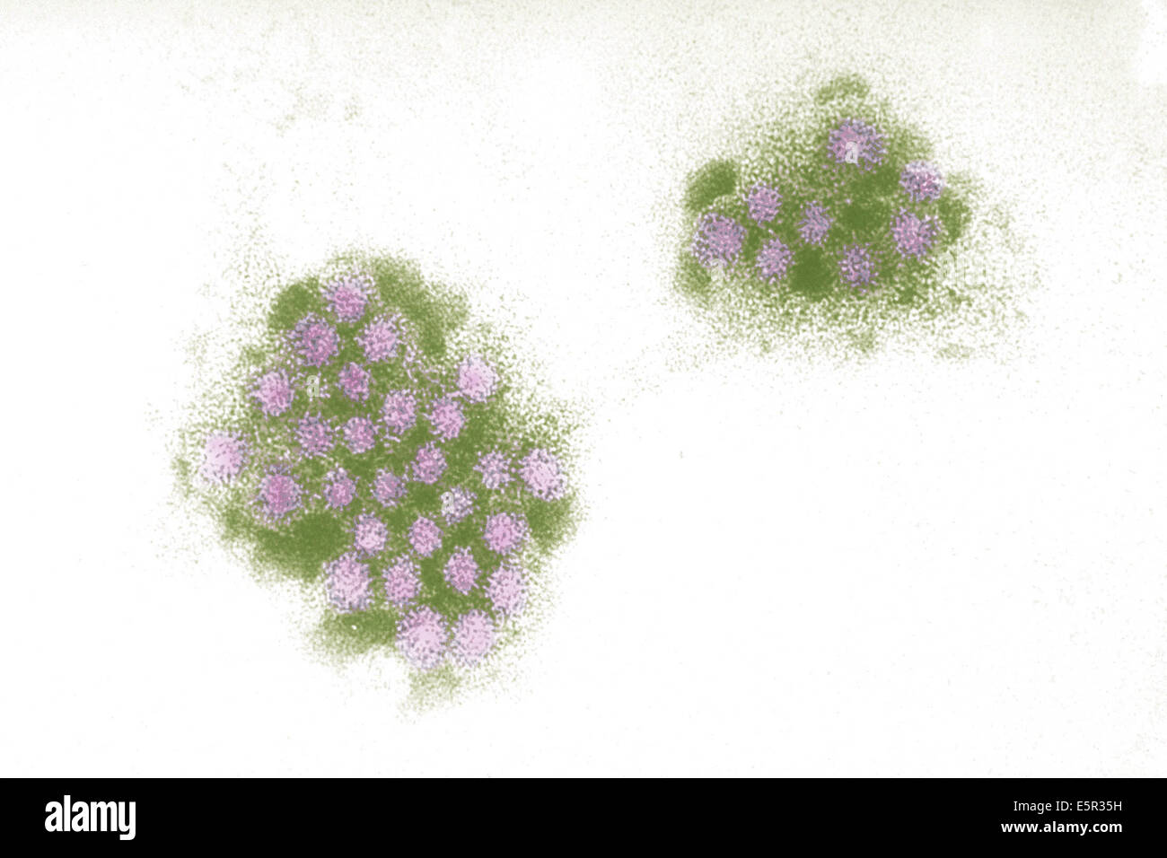 Electron micrograph of the Norwalk virus, an RNA virus the genus Norovirus (caliciviridae) responsable for gastroenteritis. Stock Photo