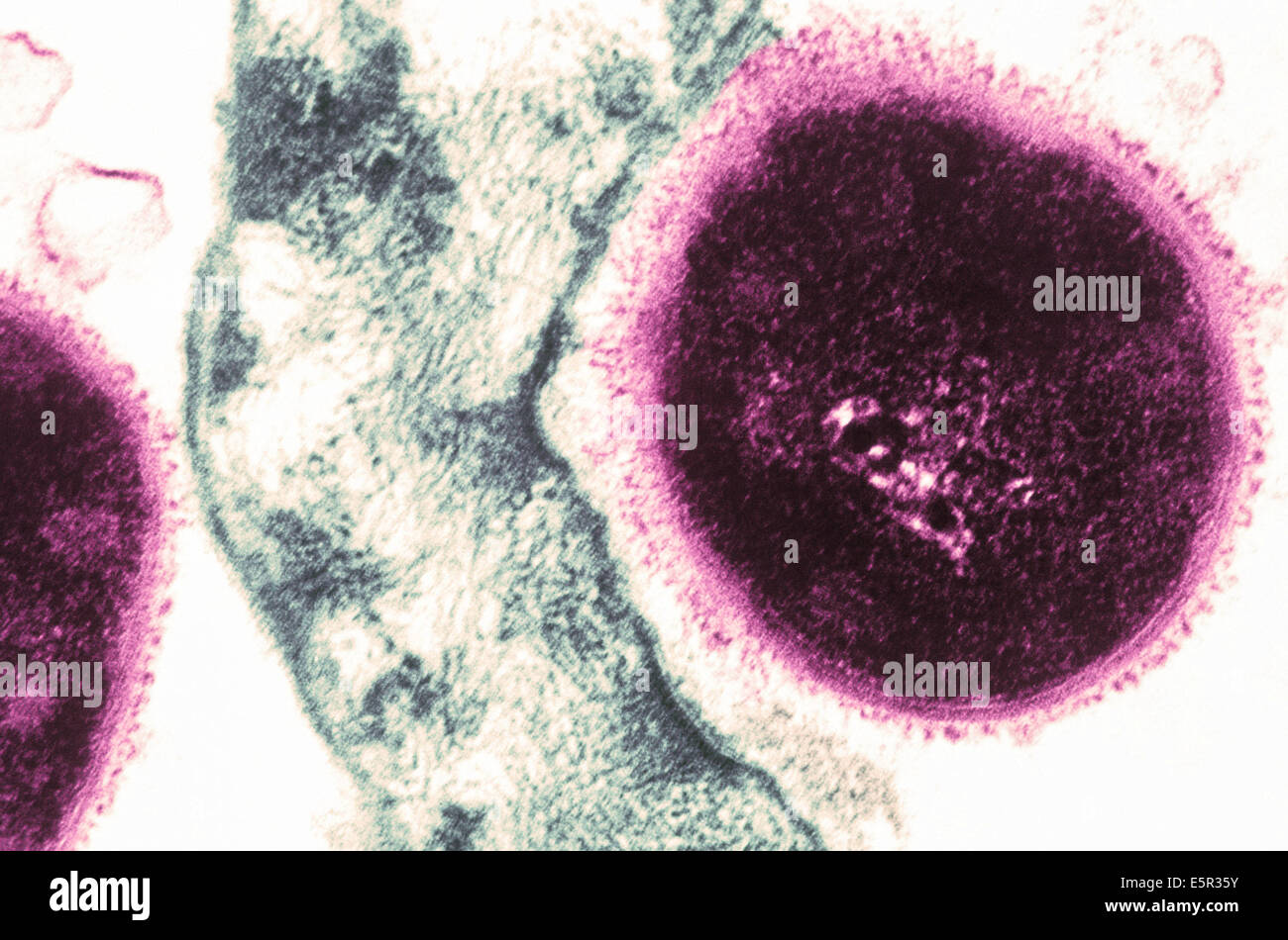 Color enhanced Transmission electron micrograph (TEM) of type 4 Streptococcus pneumoniae bacteria adherent to a pharyngeal Stock Photo