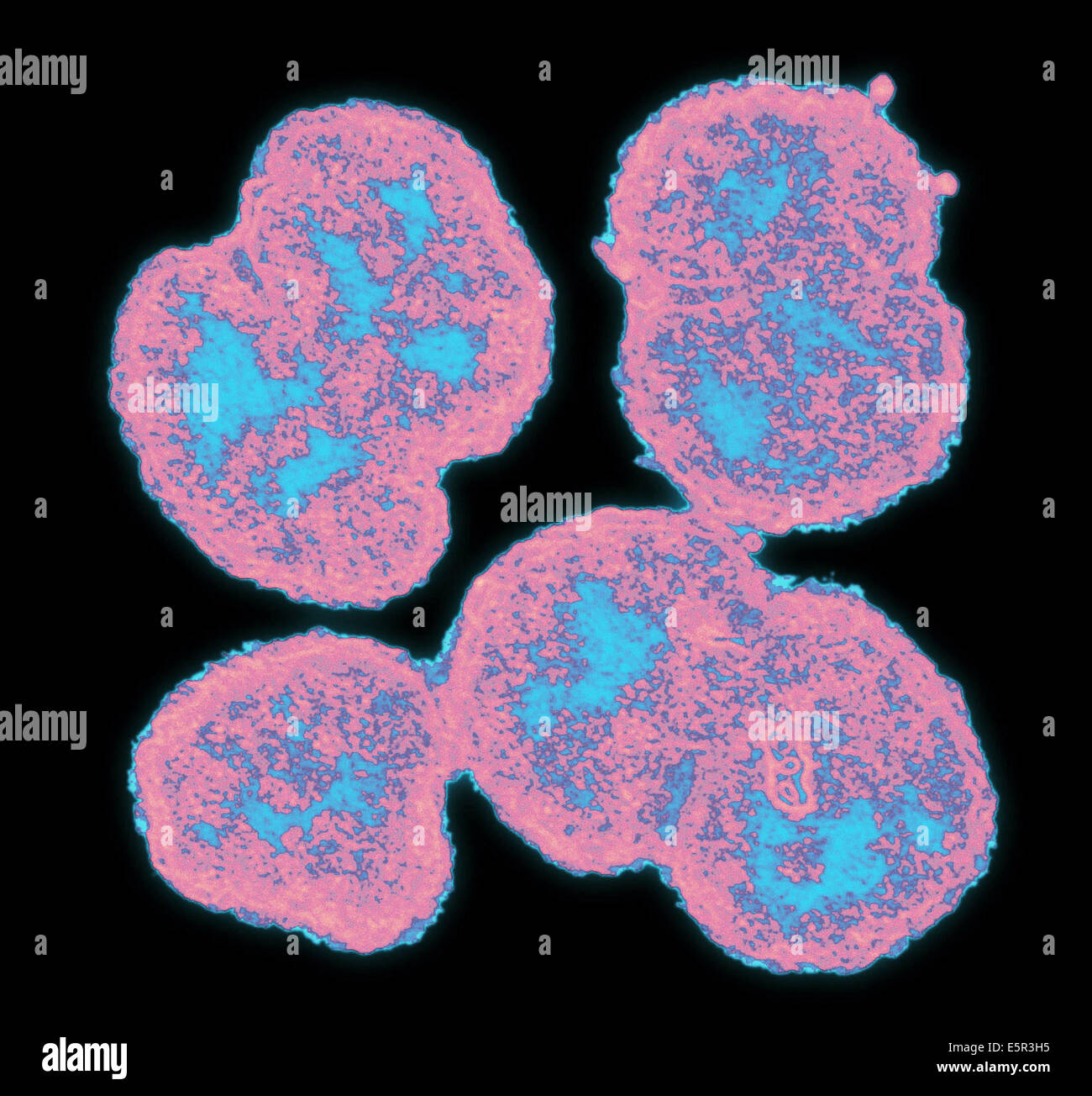 Color enhanced electron micrograph of Neisseria gonorrhoeae, an aerobic Gram-negative bacterium responsible for the Sexually Stock Photo