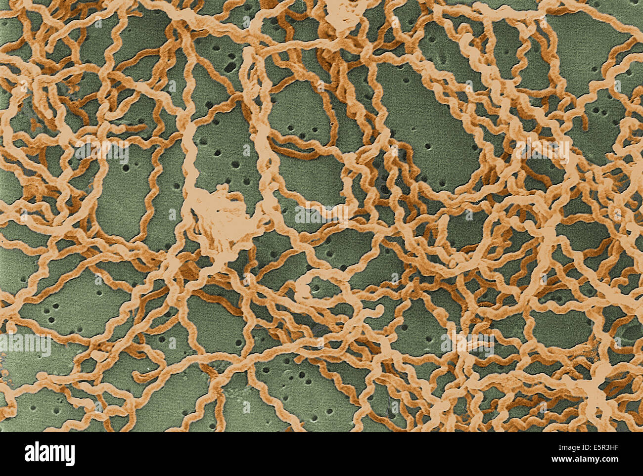 Scanning electron micrograph (SEM) of the Gram-negative bacteria Leptospira sp. Stock Photo