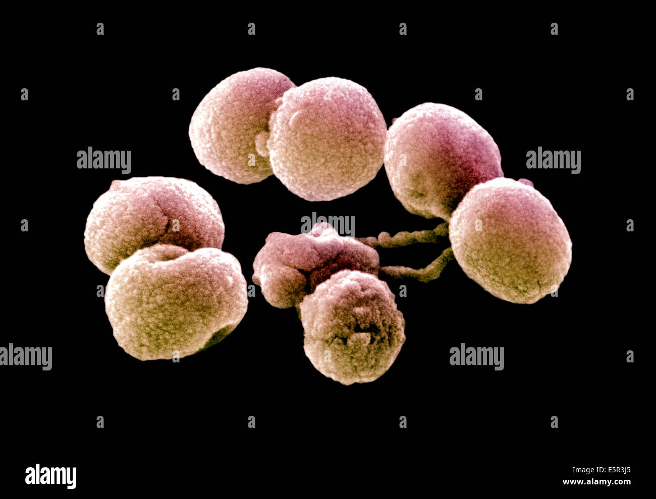Scanning Electron Micrograph (SEM) of Streptococcus pneumoniae bacteria, This Gram-negative bacterium is a leading cause of Stock Photo