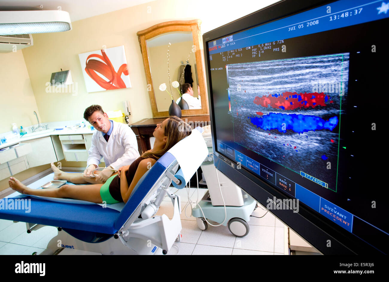 Sclerotherapy, treatment of varicose veins by injection of foam thanks